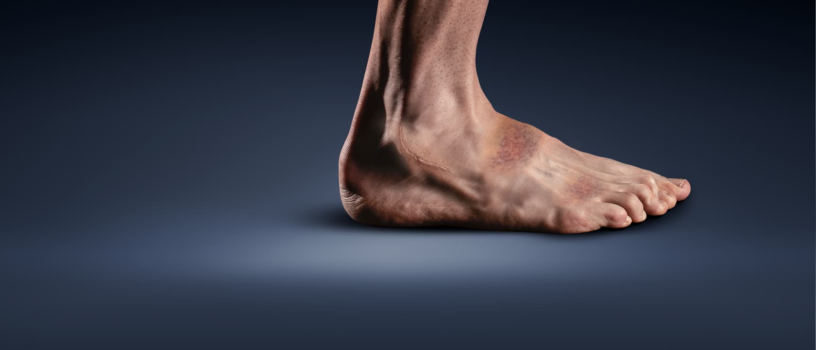 chaussure qui protège
